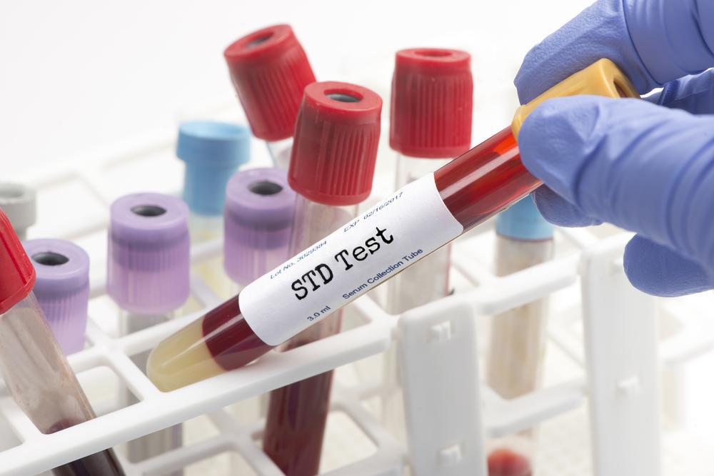 STD Test: The Rise of Home Screening Kits