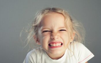 Bruxism in Children