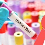 HBA1c Test price in Bangalore