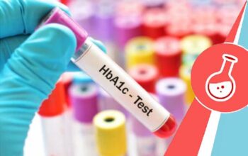 HBA1c Test price in Bangalore