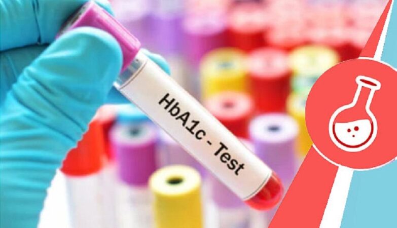 HBA1c Test price in Bangalore