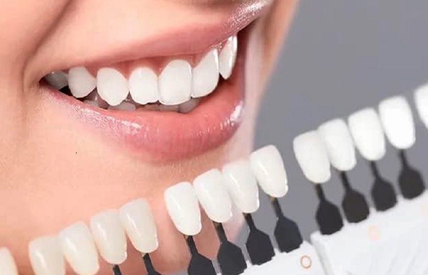 Cosmetic dental care in La Jolla: Procedures to transform your smile!