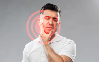 Trigeminal Neuralgia