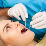 wisdom tooth extraction
